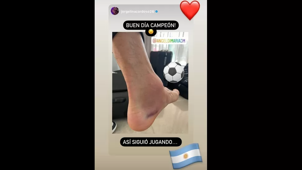 Argentina campeón de la Copa América Así quedó el tobillo de Ángel Di