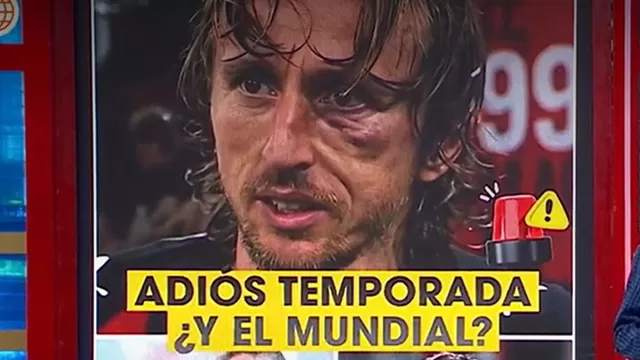 Luka Modrić: así fue la terrible fractura que sufrió el jugador. Foto: Captura Desvelados