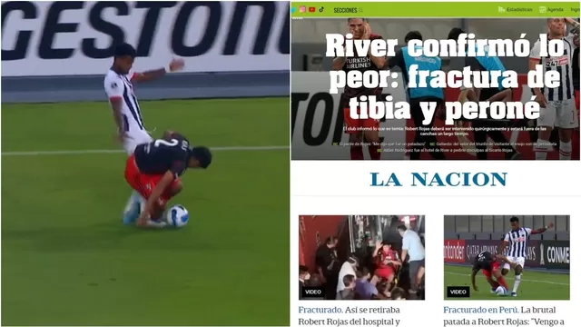 Aldair Rodríguez: Así reaccionó la prensa argentina tras la lesión de Robert Rojas