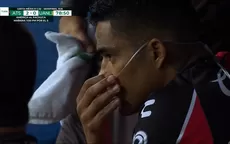 Anderson Santamaría recibió oxígeno tras ser cambiado en el Atlas vs. Tigres - Noticias de copa-america-2019