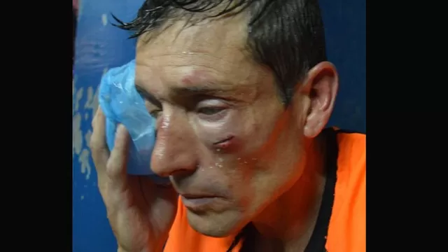 Argentina: árbitro fue atacado por no cobrar un penal