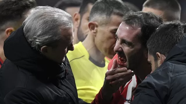 Atlético de Madrid: Diego Godín mostró su sonrisa tras perder tres dientes