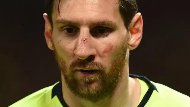 Messi será examinado este jueves tras sufrir un fuerte golpe en la nariz | Foto: AFP.