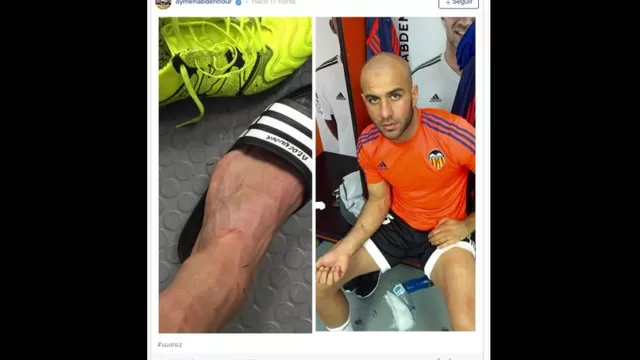 Luis Suárez pisó a defensor tunecino.-foto-2