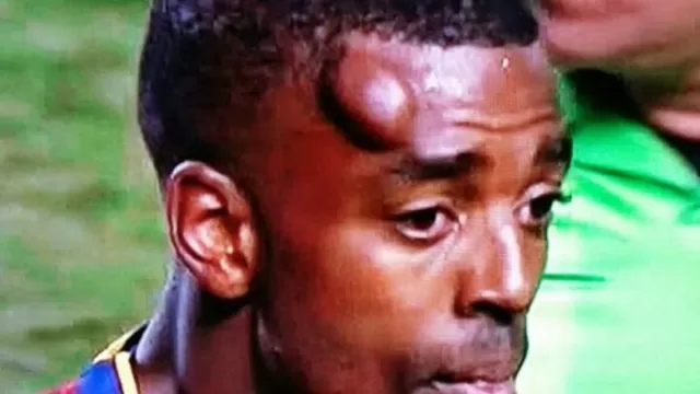 Concachampions: el impresionante golpe de Aaron Mund en duelo ante Tigres