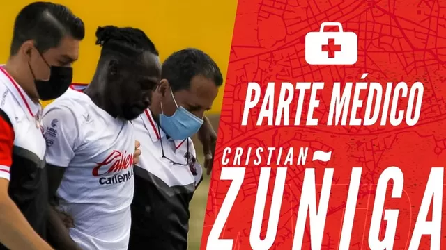 Cristian Zúñiga: Ex-Alianza Lima sufrió desgarro y estará sin jugar dos semanas