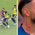 Ecuador vs Brasil: Domínguez fue expulsado tras patada a lo &#39;Chiquito&#39; Flores y no jugará ante Perú