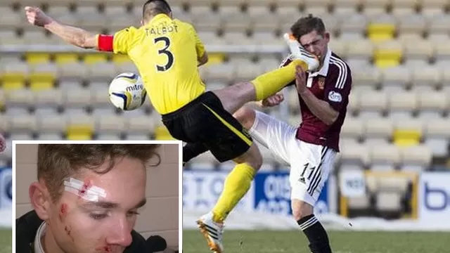 Escocia: brutal 'planchazo' a rostro de rival y solo recibió amarilla
