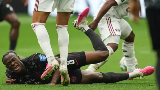 Koné sufrió la fractura de tibia y peroné por lo que queda fuera del Mundial 2026. Foto: APS / Video: ESPN