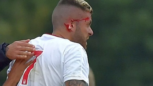Jeremy Menez del Bordeaux perdió mitad de la oreja derecha en amistoso-foto-2