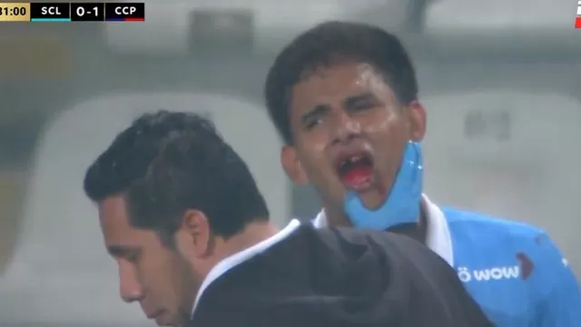 Jhilmar Lora perdió el diente en partido de Sporting Cristal ante Cerro Porteño / Captura / ESPN