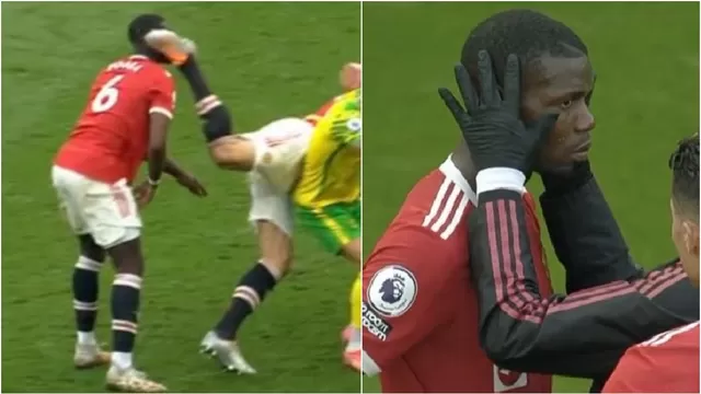Pogba fue revisado por el médico del Manchester United. | Video: Espn