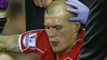 Martin Skrtel recibió pisotón en la cabeza y causó alarma en Liverpool