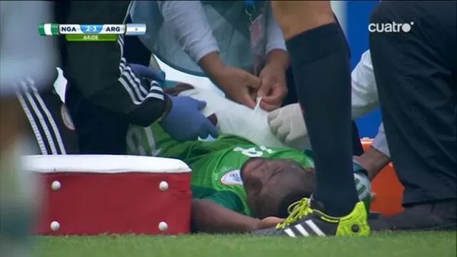 Obi Mikel le rompió el brazo a su compañero nigeriano de un pelotazo-foto-3