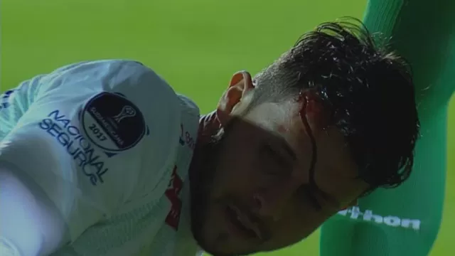 Oriente Petrolero: jugador fue agredido previo al choque con Deportivo Cuenca 