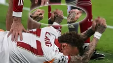 Noa Lang sufrió una grave lesión en su pulgar derecho al chocar con una valla publicitaria de Anfield. | AD