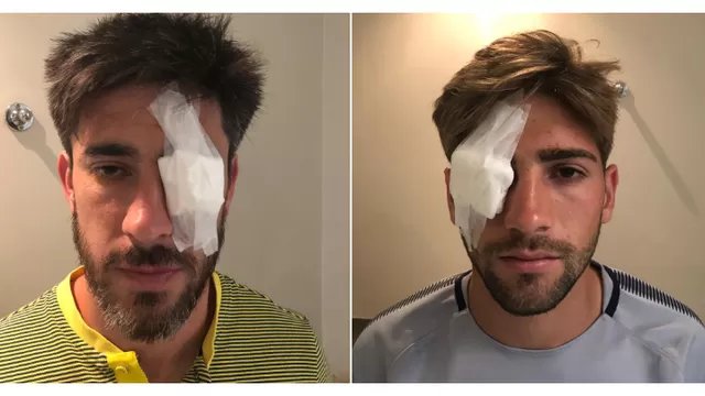 Pablo Pérez y Gonzalo Lamardo son los jugadores más afectados de Boca. | Foto: ESPN