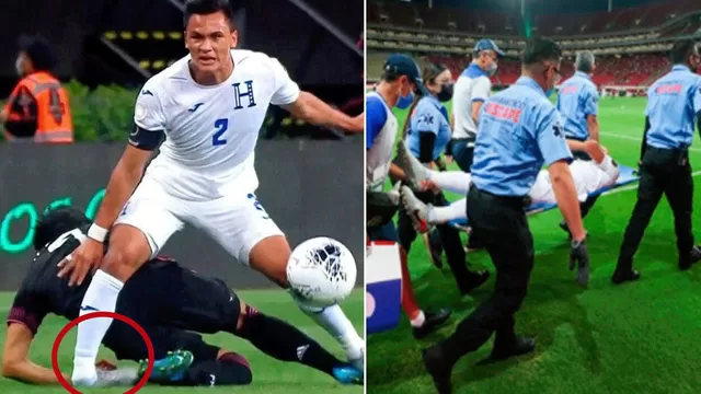 YouTube: Terrible lesión de tobillo de Denil Maldonado en el México vs. Honduras por el Preolímpico