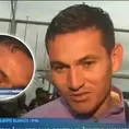 Jairo Vélez mostró cómo quedó su rostro tras recibir codazo en el Alianza Lima vs Comerciantes