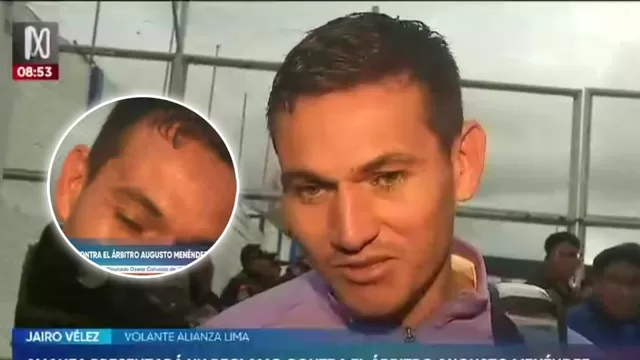 Jairo Vélez sorprendió al mostrar cómo quedó su rostro luego de recibir un codazo en el Alianza Lima vs Comerciantes Unidos | Fuente: Canal N