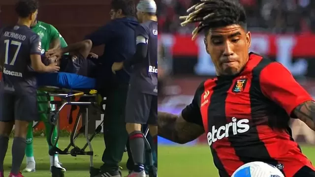 Paolo Reyna: Escalofriante lesión del jugador de Melgar impacta a nivel internacional