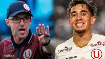 Universitario: Jugadores que podrían reemplazar a Pérez Guedes