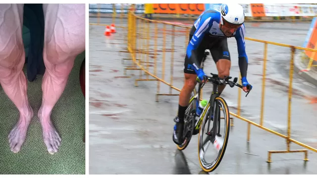 Así le quedan las piernas a un ciclista tras 18 etapas del Tour de Francia