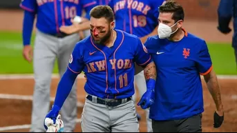 Béisbol: Jugador de New York Mets sufrió múltiples fracturas tras recibir pelotazo en la nariz