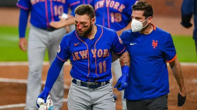 Béisbol: Jugador de New York Mets sufrió múltiples fracturas tras recibir pelotazo en la nariz