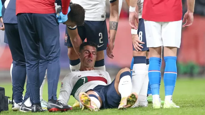 Cristiano Ronaldo: Así quedó su rostro tras violento choque en la Nations League