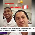 Gianluca Lapadula: La impactante imagen de cómo quedó su nariz tras victoria ante Colombia