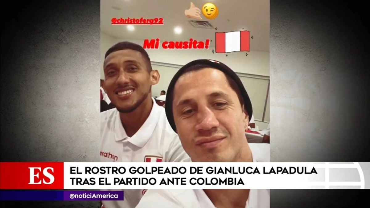 Gianluca Lapadula Y Cómo Quedó Su Rostro Instantes Después De Violento Golpe América Deportes 6714