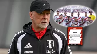 A través de un comunicado oficial, la 'Bicolor' anunció que el jugador regresará a su club para iniciar su proceso de recuperación. | AD - Bicolor