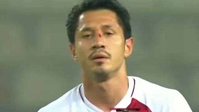 Perú vs. Colombia: Gianluca Lapadula acabó el partido con un corte en la nariz