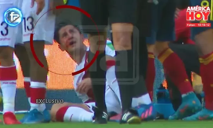 Gianluca Lapadula Y C Mo Qued Su Rostro Instantes Despu S De Violento Golpe Am Rica Deportes