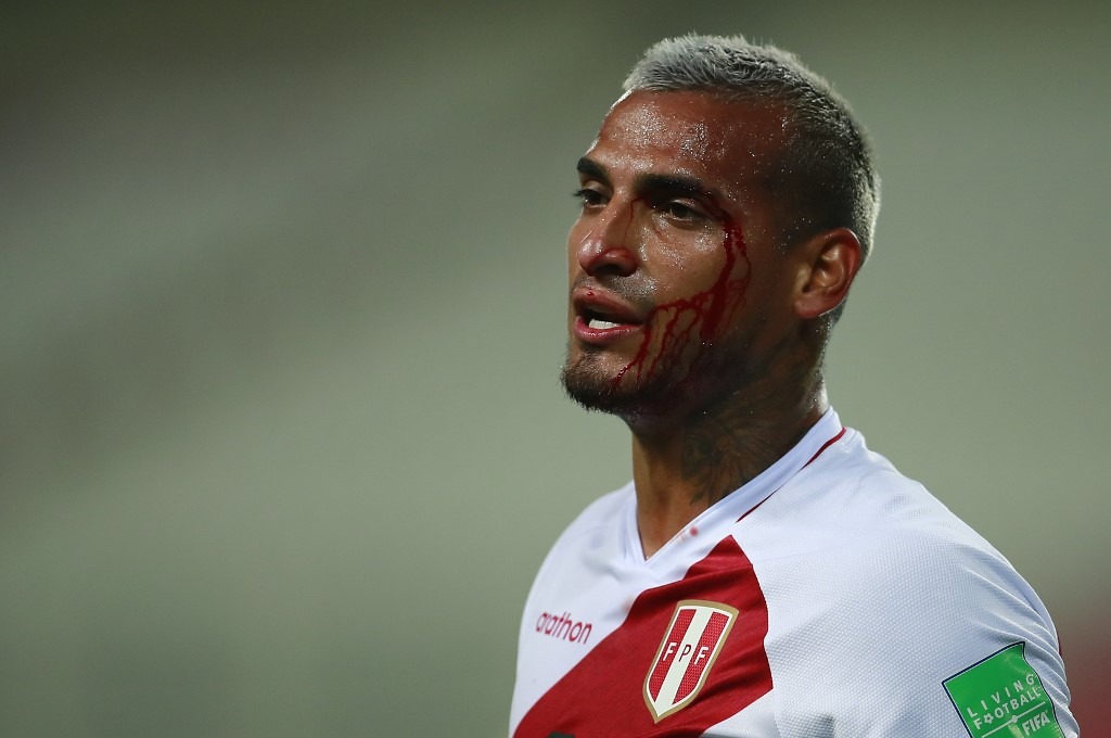 Miguel Trauco acabó ensangrentado en el partido entre Perú y Brasil | Foto: AFP.