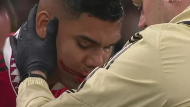 Casemiro recibió un duro golpe en el encuentro entre Manchester United y Sheriff